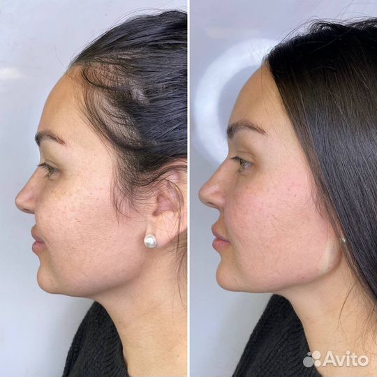 Услуги косметолога