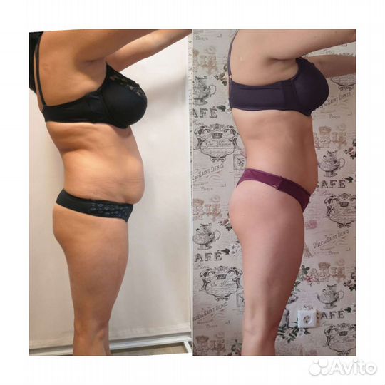 Кавитация, вибро массаж, LPG массаж