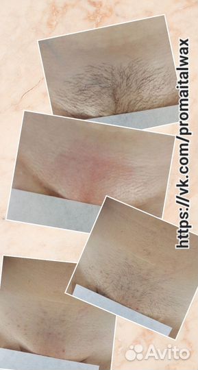 Восковая депиляция