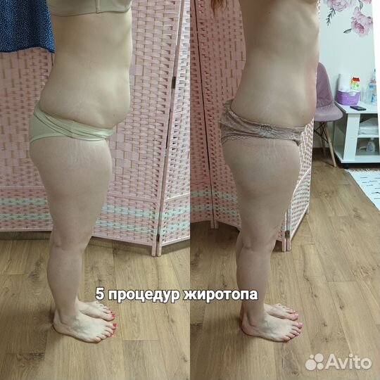 Жиротоп,топим Ваш жирок,Коррекция фигуры,похудение