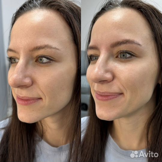 Оформление бровей ламинирование бровей