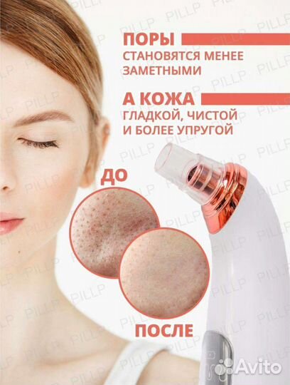 Вакуумный аппарат для чистка лица