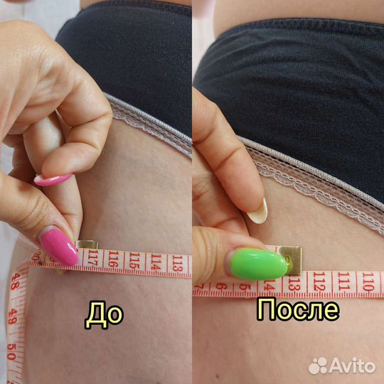 LPG массаж/ кавитация/ вибромассаж