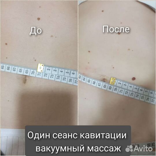 Модель для похудения