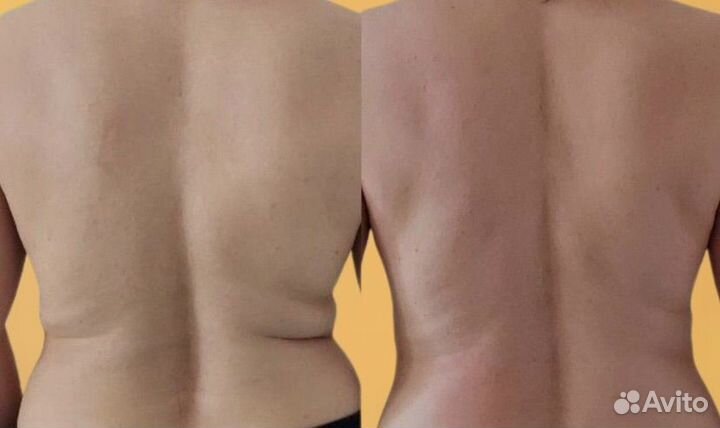 Вибромассаж