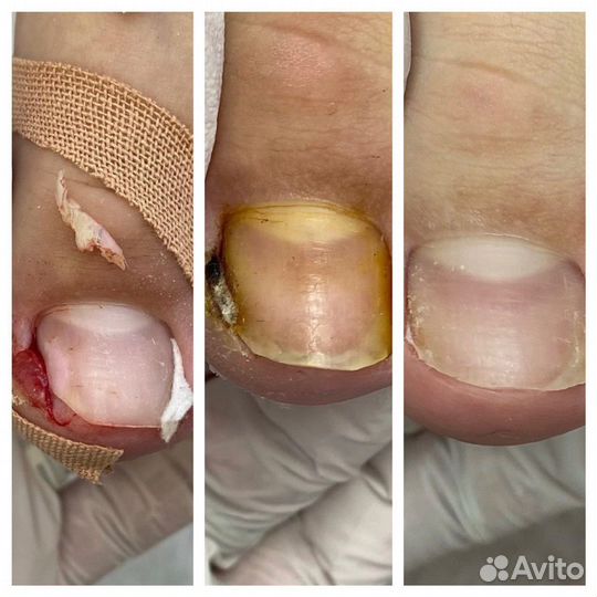 Подолог. Здоровье стоп и ногтей