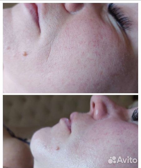 Косметик-Эстетист. Депиляция